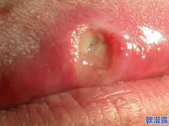 舌头探洞水好多怎么办？专家教你如何应对这一奇怪现象，保护口腔健康！