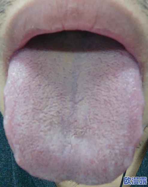 舌头探洞水好多怎么办？专家教你如何应对这一奇怪现象，保护口腔健康！