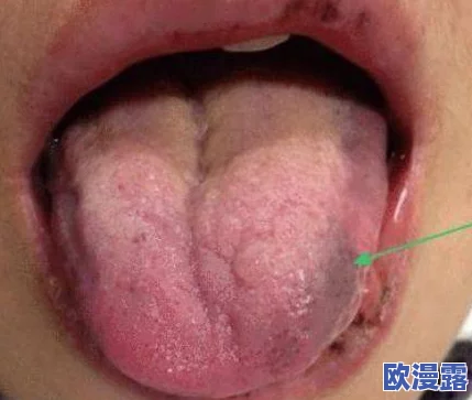 舌头探洞水好多怎么办？专家教你如何应对这一奇怪现象，保护口腔健康！
